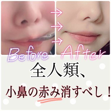 スタック 旅 しない コンシーラー 鼻 の 赤み Pretty Monroe Jp