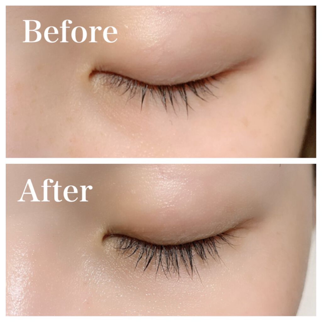 Emaked 水橋保寿堂製薬の効果に関する口コミ L𝐄𝐌𝐀𝐊𝐄𝐃本当に伸びる 話題のまつげ By ちゃんまり 乾燥肌 代後半 Lips