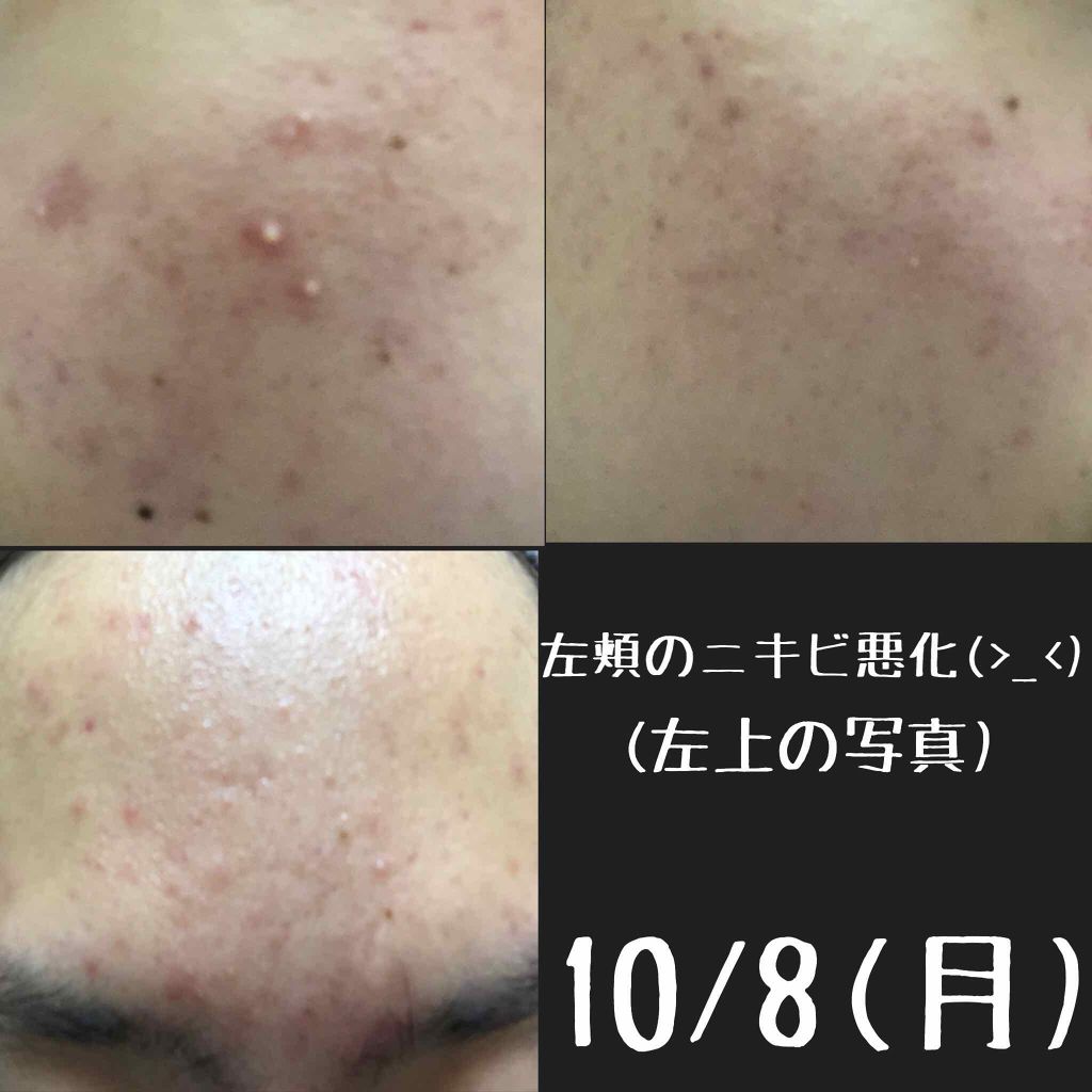 ニベアクリーム ニベアを使った口コミ こんにちは 現在高校1年生の私は とてもニ By あい 混合肌 10代後半 Lips