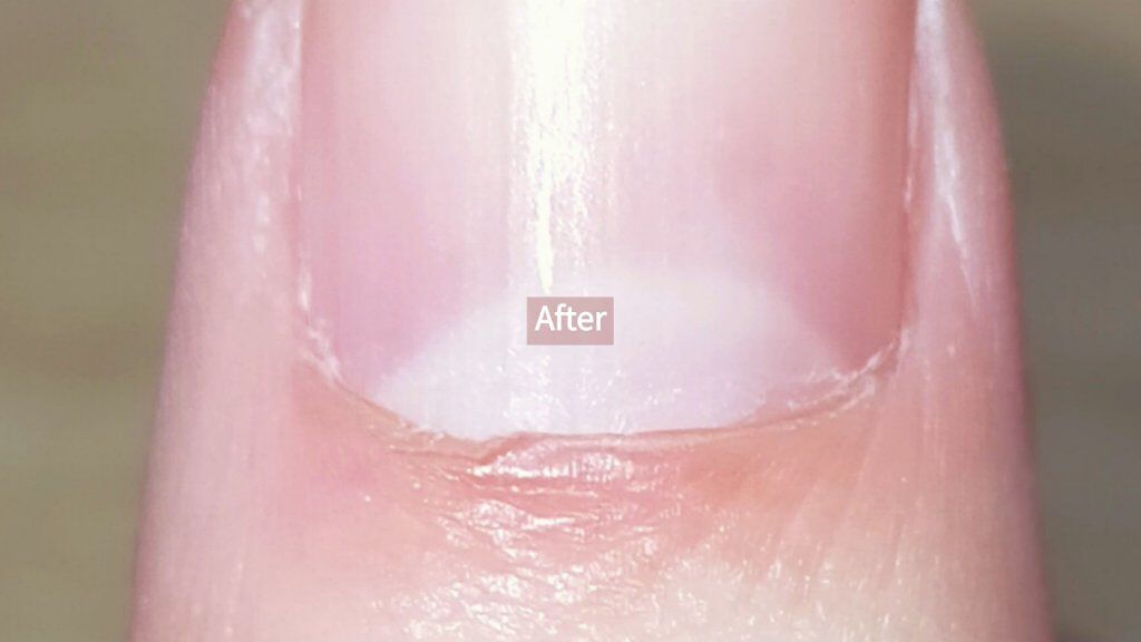 アドバンスドリペア ボディローション ヴァセリンを使った口コミ 甘皮の処理してみました 手順 指にハン By やづあ 脂性肌 10代後半 Lips