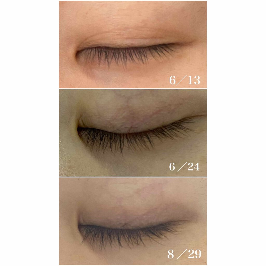 Emaked 水橋保寿堂製薬の口コミ こんばんは 絵文字こわ 今日は 趣向を変 By 木村氏 乾燥肌 代後半 Lips