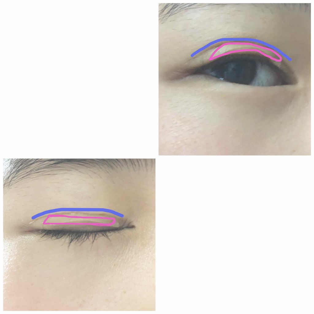 二重になる方法 のび る アイテープ 両面テープタイプ Daisoの使い方や二重メイク 初めまして 私は元は両 By ゆぴ 普通肌 10代後半 Lips