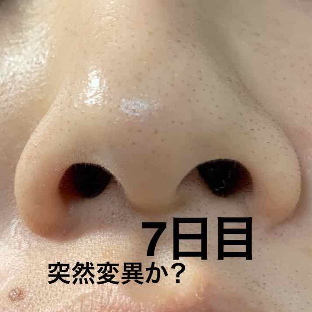 オバジc 酵素洗顔パウダー オバジの口コミ 敏感肌におすすめの洗顔パウダー いちご鼻脱却 酵素洗 By ニカ 敏感肌 代前半 Lips