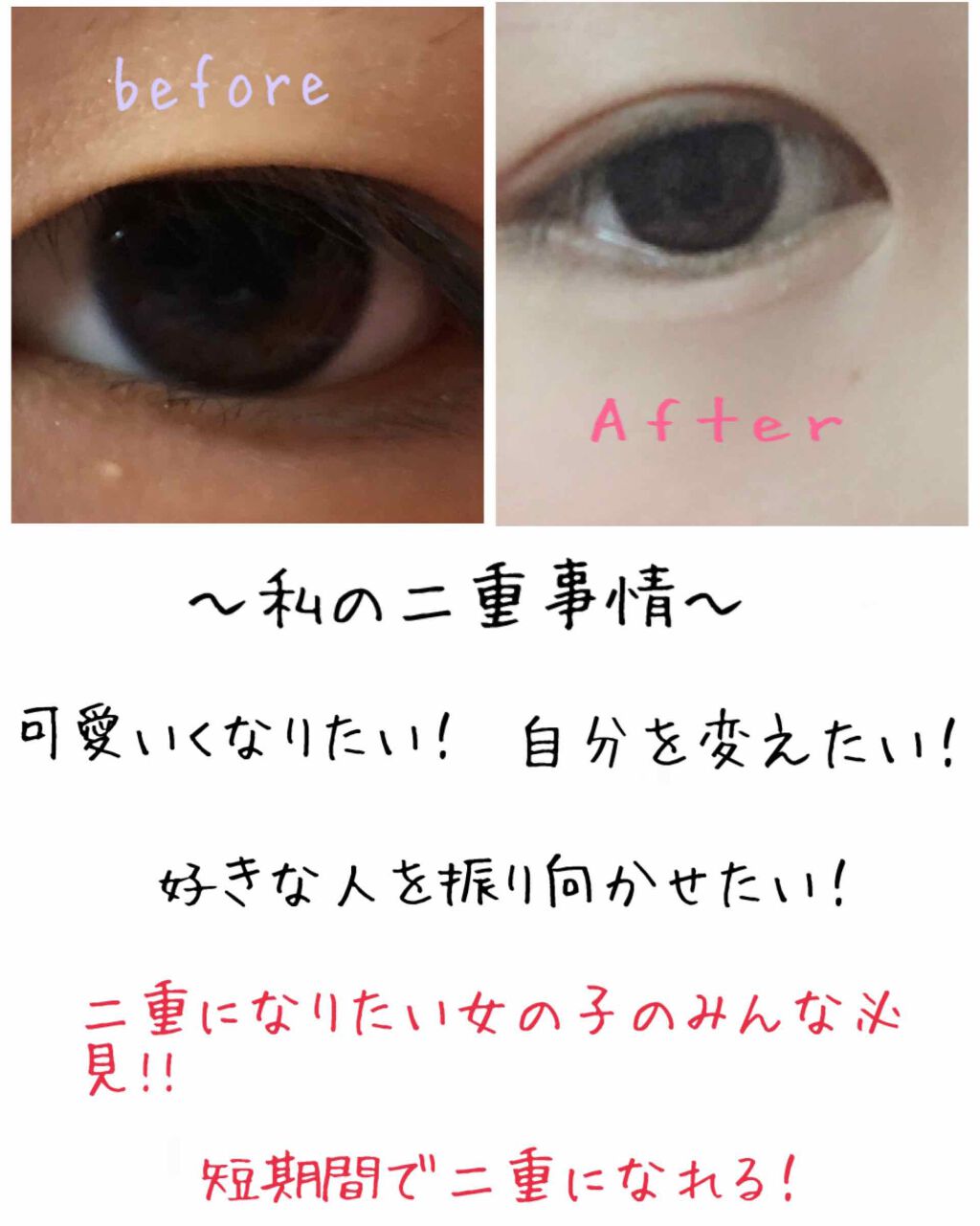 Sh ダブルアイリッド セリアの口コミ 超優秀 100均で買えるおすすめ二重まぶた用アイテム 今回は奥二重で悩んでい By Yura 乾燥肌 10代前半 Lips