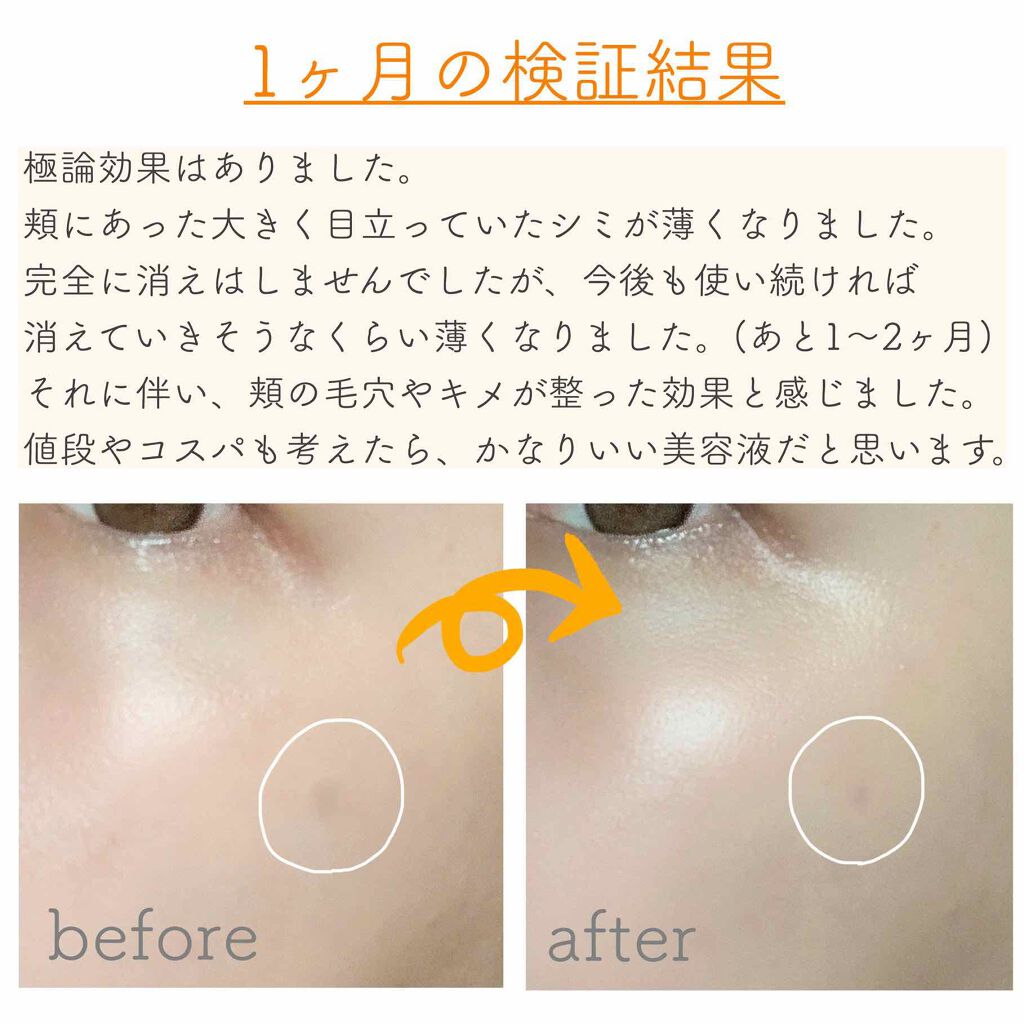 薬用 しみ 集中対策 美容液 メンソレータム メラノccの効果に関する口コミ 敏感肌におすすめの美容液 今回は 日本でバズって By Koyagi 乾燥肌 代後半 Lips
