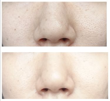 スムースマットベース Orbisの辛口レビュー 結論 By カピ みかん肌代表 乾燥肌 代後半 Lips