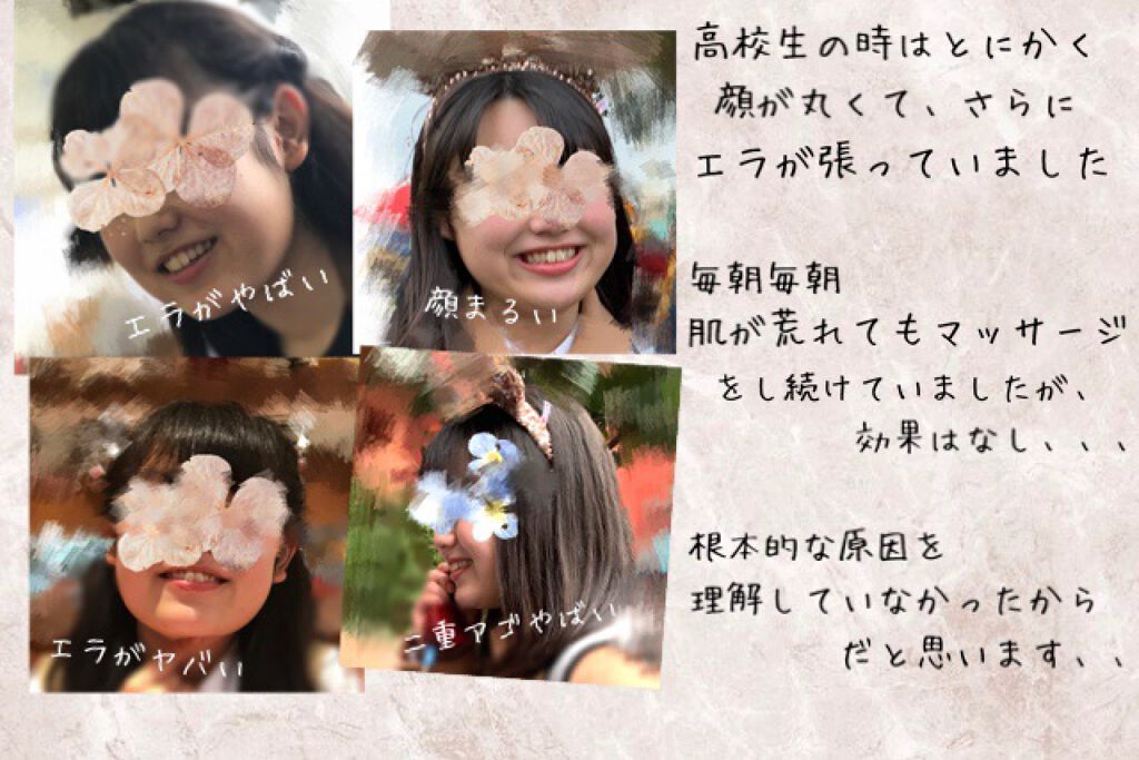 Nicobelt ニコベルト Vonmieの口コミ 顔痩せ ニコベルトは効くのか By Ryo Lips