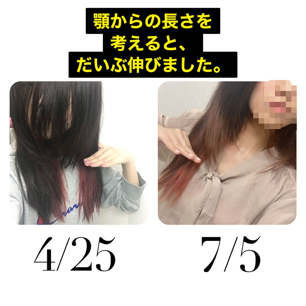ヘアアクセルレーター レモンライムの香り 加美乃素本舗の口コミ 加美乃素本舗ヘアアクセルレーター 内容量 By 愛梨花 普通肌 代前半 Lips
