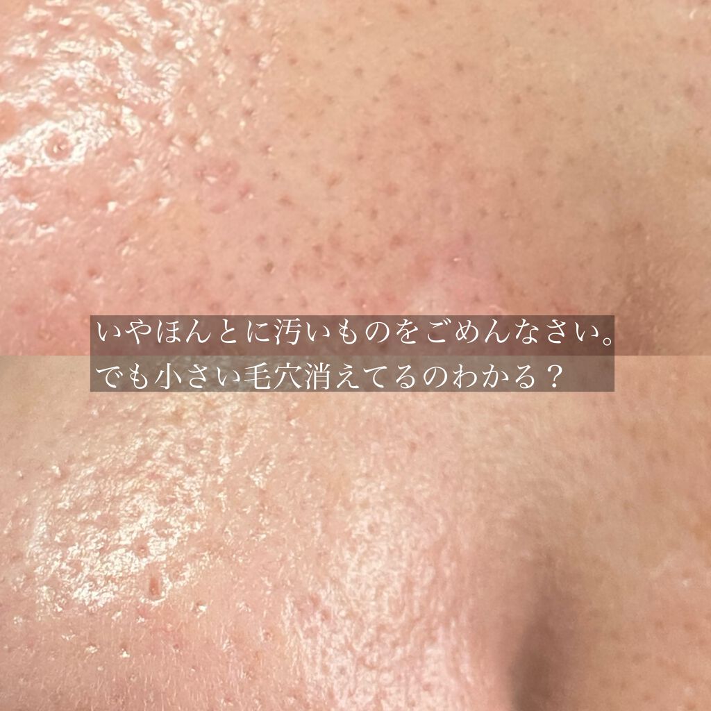 シルキーバームプライマー Addictionの口コミ 開き切った鼻の毛穴をナチュラルにカバーして By みそこ 混合肌 30代前半 Lips