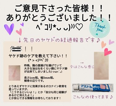 アズノール軟膏0 033 医薬品 日本新薬のリアルな口コミ レビュー Lips