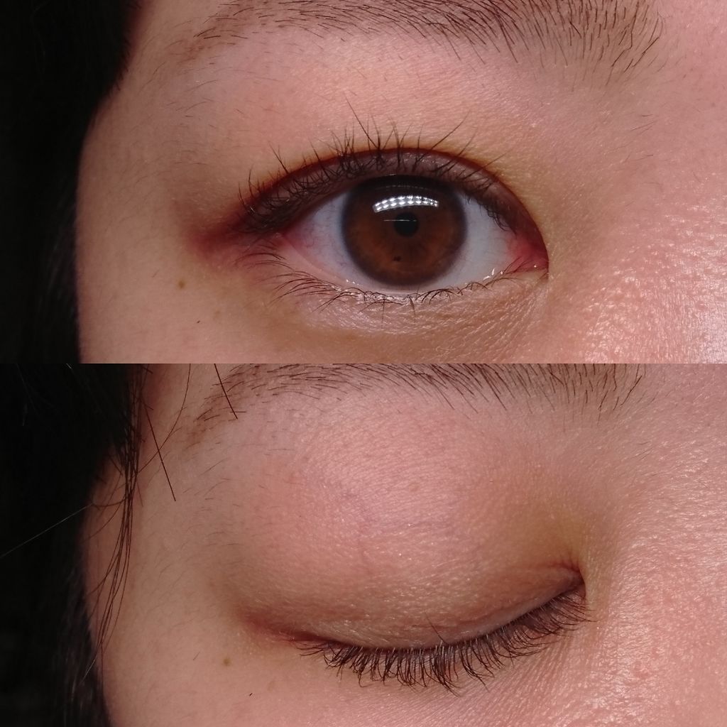 コエンザイムq10配合 美容液 Daisoの口コミ コエンザイムq10配合美容液 ダイソー By ごまちゃん 敏感肌 代後半 Lips