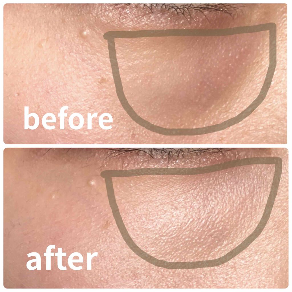 シークレットコンシーラー Laura Mercierの口コミ 乾燥肌におすすめのコンシーラー ローラメルシエ シーク By Nan 乾燥肌 代前半 Lips