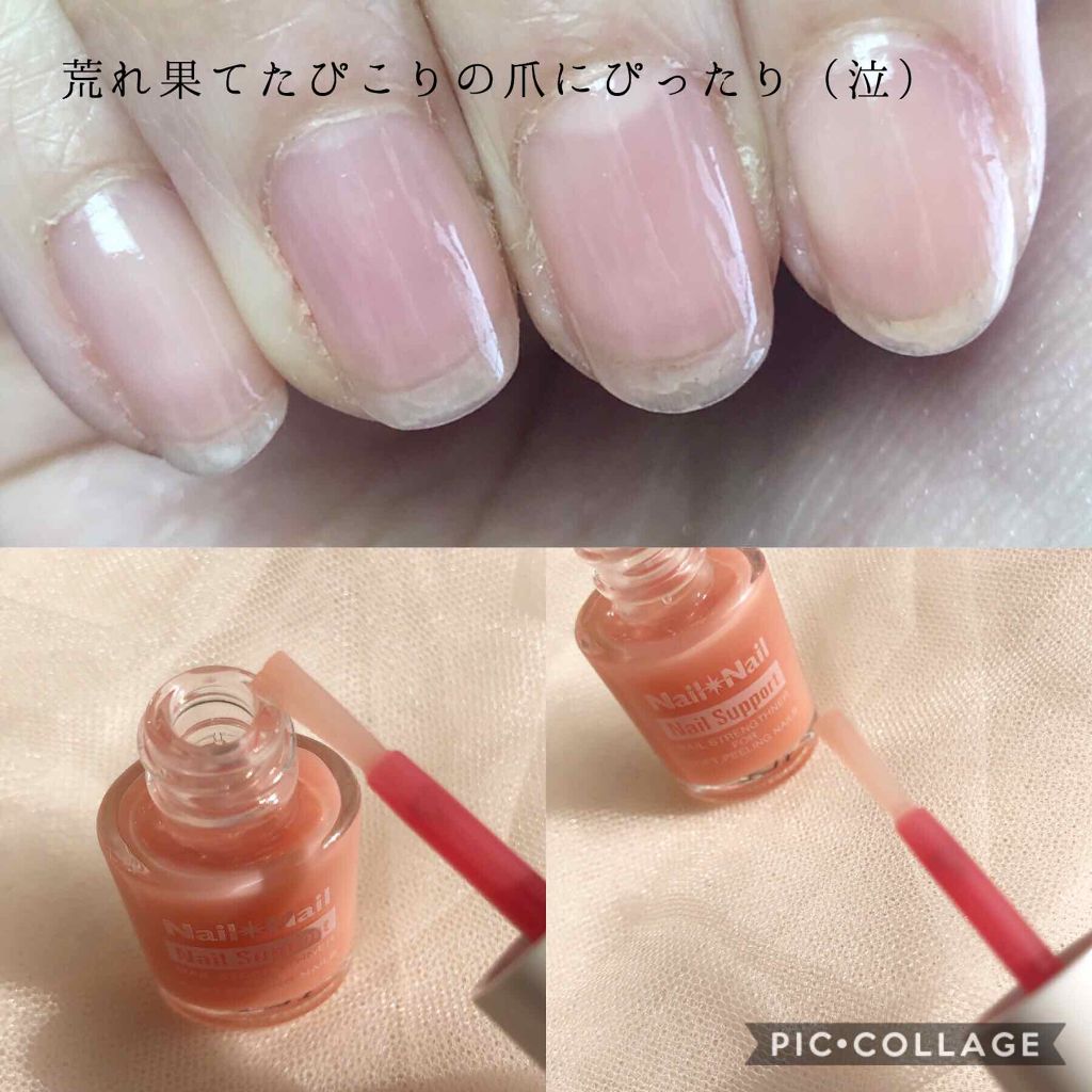 ネイルサポート ピンク ネイルネイルの口コミ ぴこねいる 健康的 な美爪がいい By ぴこり Picocosme100 普通肌 Lips