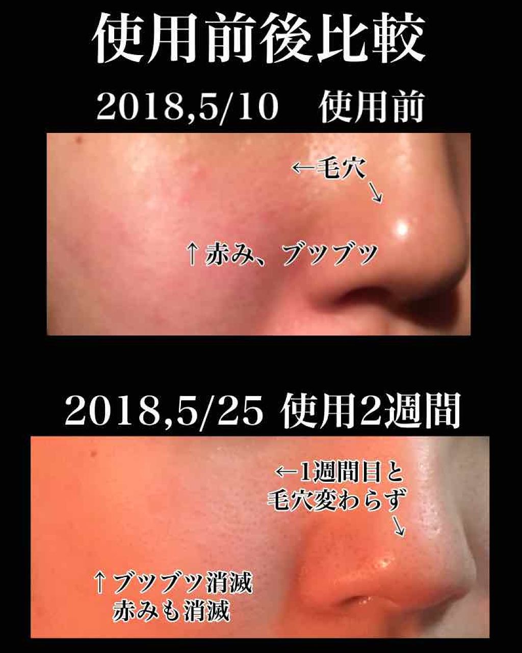 ウォッシャブル コールド クリーム ちふれの効果に関する口コミ 話題のものが肌に合わず 非常に遺憾に思って By 中河 乾燥肌 代後半 Lips