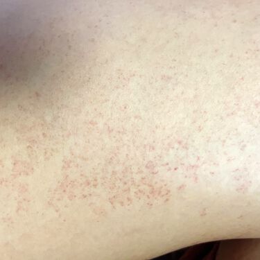 ジョンソンベビーオイル微香性 ジョンソンベビーの辛口レビュー お風呂上がりの乾燥が気になって値段の安さに By ゆゆ 乾燥肌 Lips