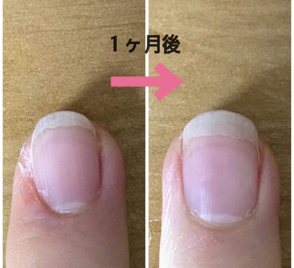 キューティクルオイルペン ネイル工房の使い方を徹底解説 こんにちは 突然すぎますが みな By 𝐬𝐲𝐮𝐫𝐚 乾燥肌 Lips