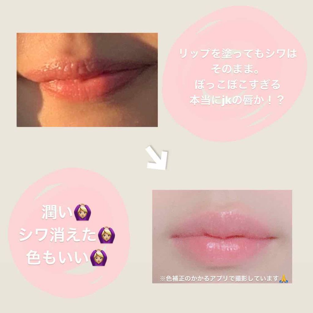 レブロン キス シュガー スクラブ Revlonの口コミ 皆さんの気になる唇レブロンのシュガースクラ By にゅーら アトピー肌 10代後半 Lips