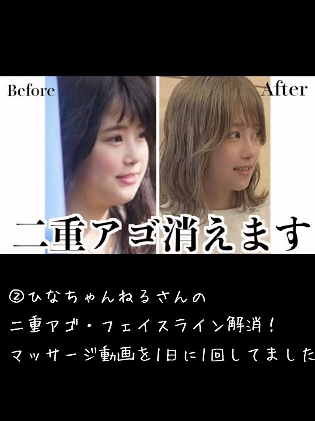 メジカライナー ナイト ハード シェモアの口コミ 一重から二重になった方法 私が一重から二重 By おなごちゃん アトピー肌 10代後半 Lips