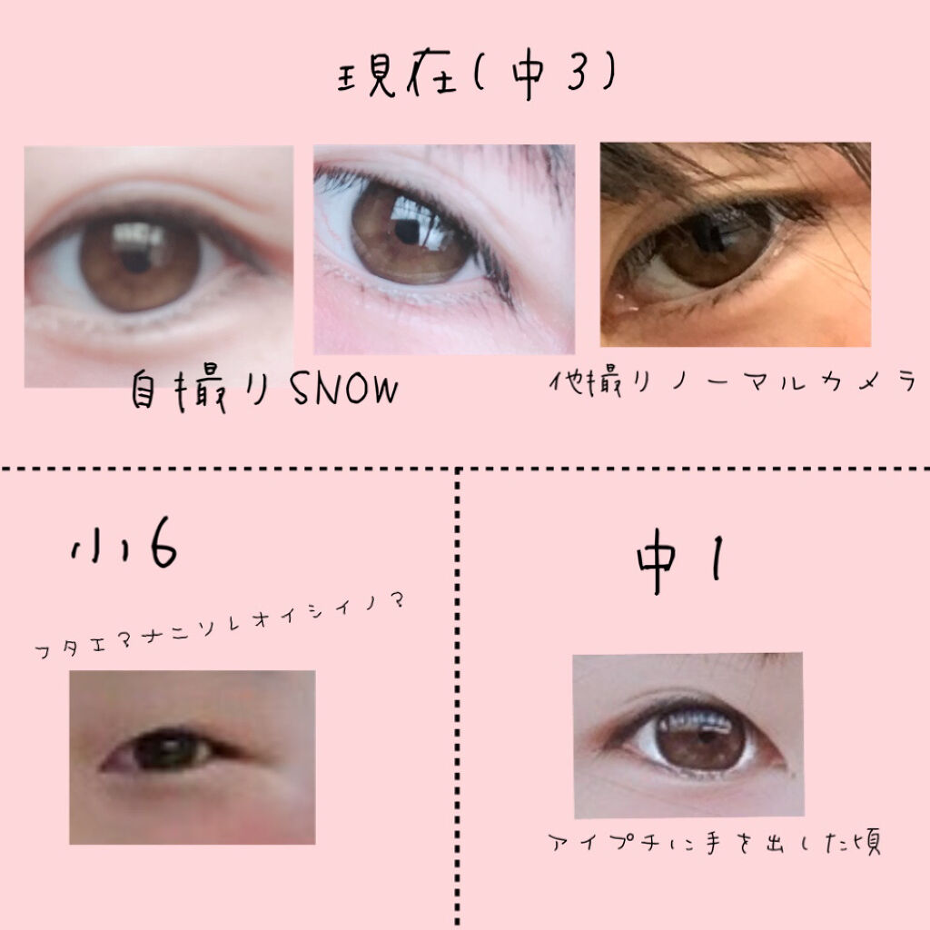 二重になる方法 のび る アイテープ 絆創膏タイプ Daisoの使い方や二重メイク アイプチなしでくっきり By そばかす 敏感肌 10代後半 Lips