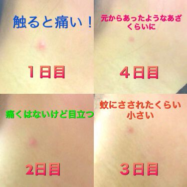 明色 美顔水 薬用化粧水 明色化粧品の口コミ 美顔水の魔法学生の時からニキビがでるとしば By 葵 乾燥肌 代後半 Lips