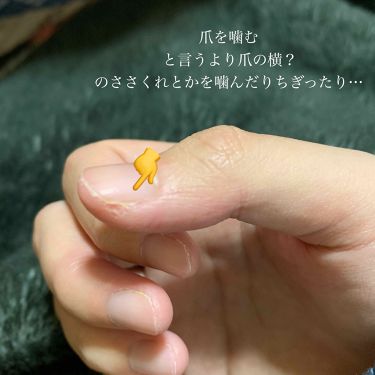 ディープセラム Dr Nailを使った口コミ 爪噛み癖 辞めます 綺麗な爪とか何もネイ By あ ま と う 乾燥肌 10代後半 Lips