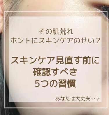 シナールｅｘチュアブル錠 医薬品 シオノギ製薬のリアルな口コミ レビュー Lips