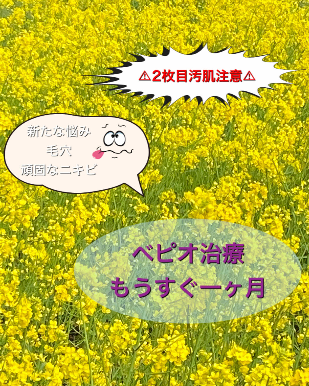 ベピオゲル 医薬品 の口コミ こんばんは 自宅待機が長引きそうですが皆さ By Amin 敏感肌 30代前半 Lips