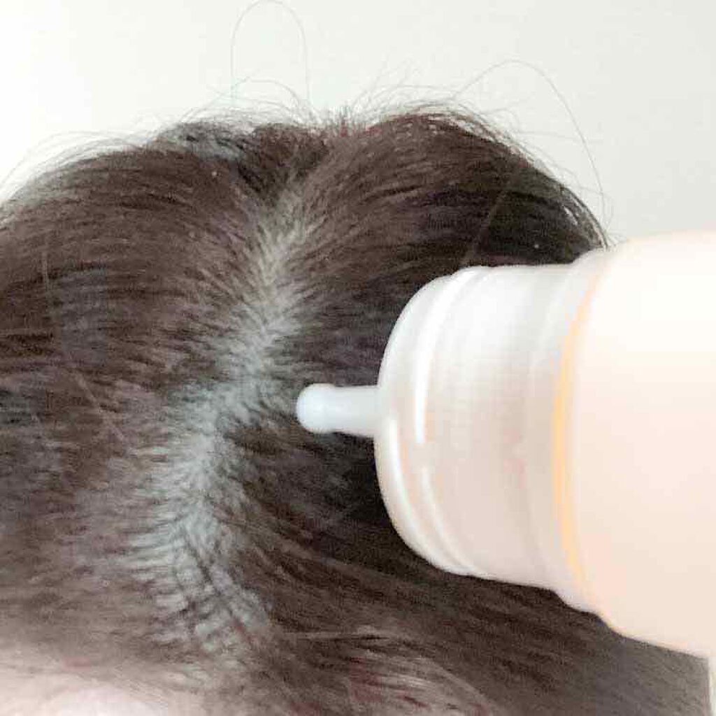 マイナチュレ 無添加育毛剤 マイナチュレの口コミ マイナチュレシリーズ無添加育毛剤頭皮負担に By Pipi3 普通肌 30代前半 Lips