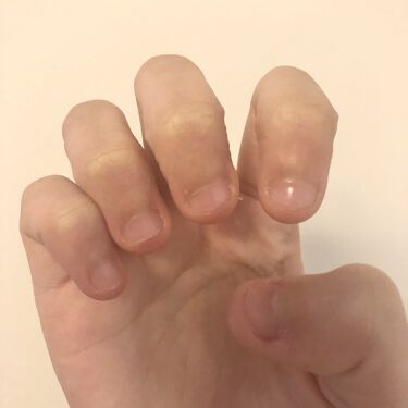 ハンドベール プレミアムリッチネイル メンソレータムを使った口コミ 爪噛み癖をしっかりと治す 爪噛みについて By れもん 乾燥肌 10代後半 Lips