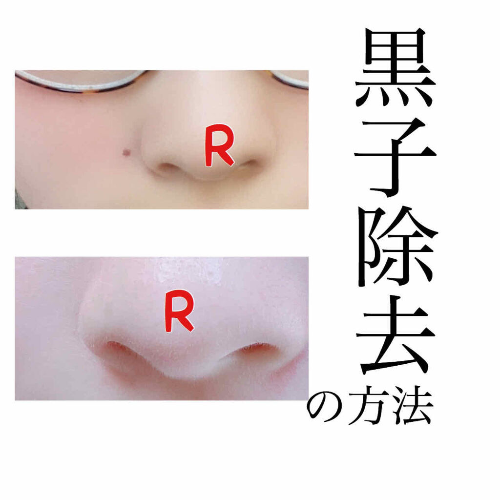 スキンケア方法 加香ひまし油 医薬品 日本薬局方の使い方 効果 こんにちは ˊᵕˋ by lips