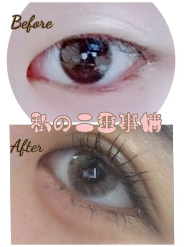 アイプチ Daisoのリアルな口コミ レビュー Lips