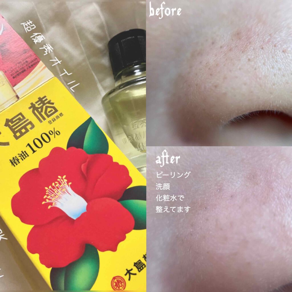 大島椿 ツバキ油 大島椿の口コミ 鼻のドアップ写真があります By るぁめろメイク アトピー肌 代前半 Lips