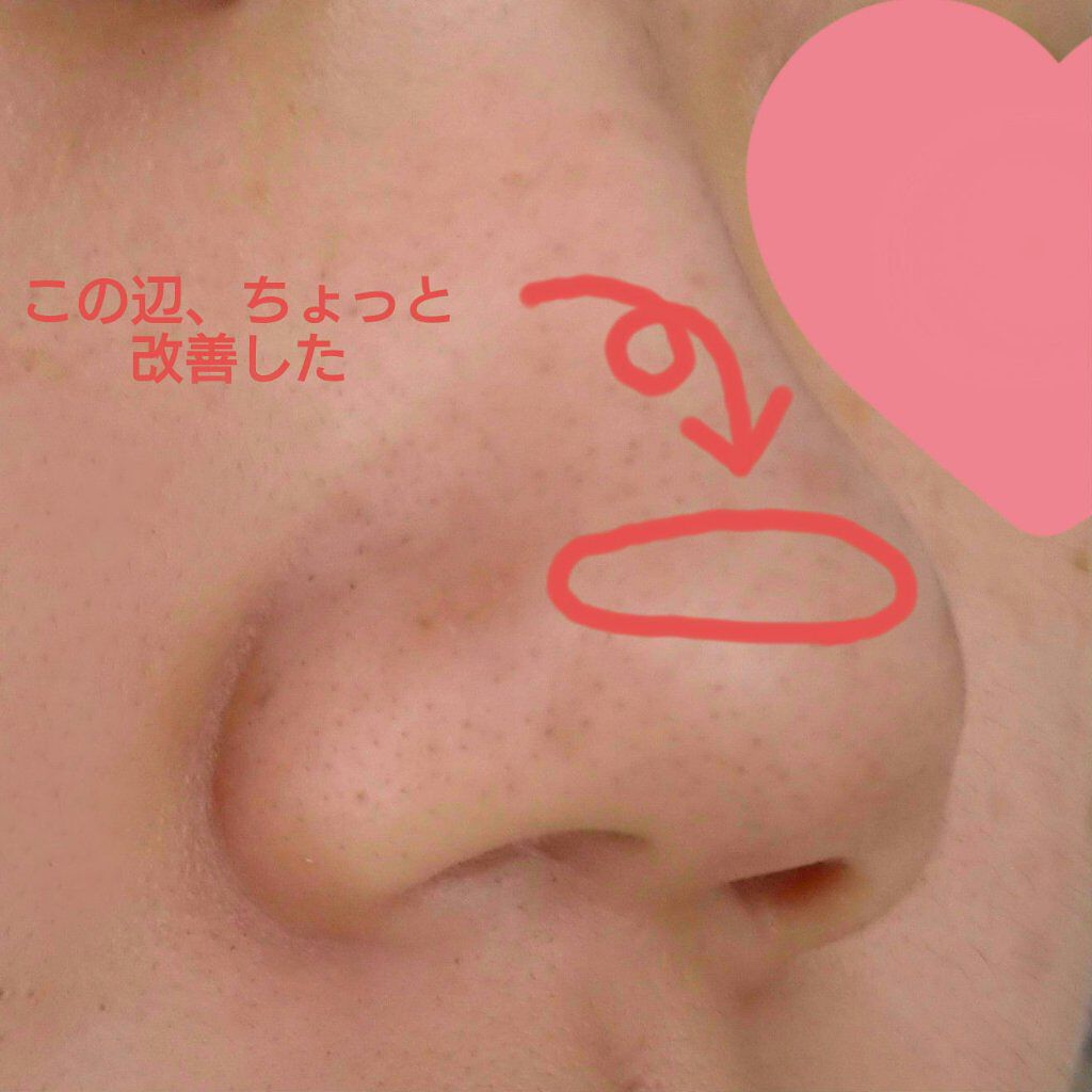 ドット ウォッシー洗顔石鹸 ペリカン石鹸の効果に関する口コミ 苺鼻 改善したくない こんにちは いつも By 薩摩 芋子 アイコン変えました アトピー肌 10代後半 Lips