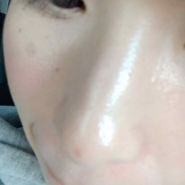 アミノモイスト ぷるぷるしっとり肌マスク ミノンの口コミ 乾燥肌におすすめのシートマスク パック ２枚目に汚肌あり By めがね屋 乾燥肌 代後半 Lips