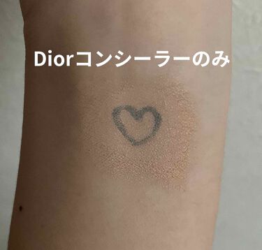 ディオールスキン フォーエヴァー スキン コレクト コンシーラー Diorの使い方を徹底解説 乾燥肌におすすめのコンシーラー そばかすに悩む女子のお By Ria フォロバ 混合肌 10代後半 Lips