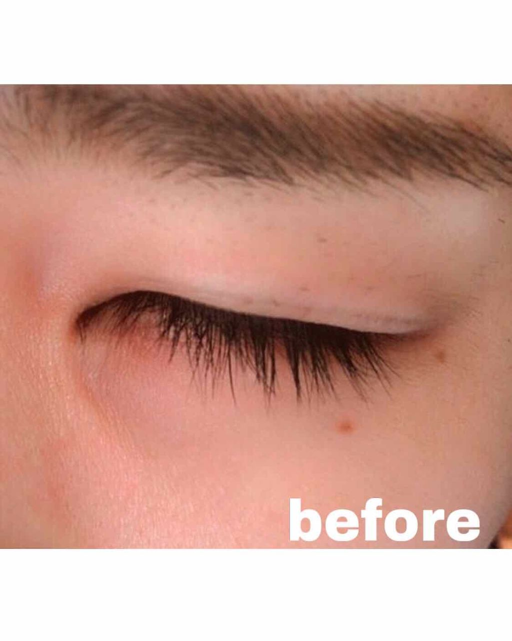 エグータム アルマダスタイルの効果に関する口コミ 1枚目 エグータムを使い始める前の元々の By Kure 混合肌 代前半 Lips