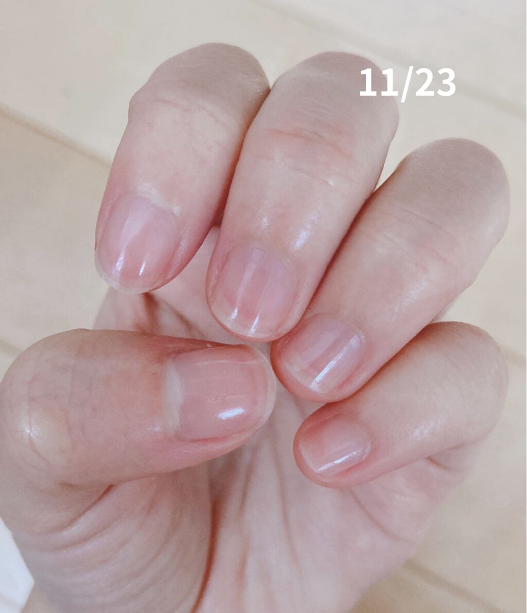 デイケアオイル Dr Nailを使った口コミ 手が小さい上に爪もこんなんじゃ子供みたい By あいこ 敏感肌 代後半 Lips