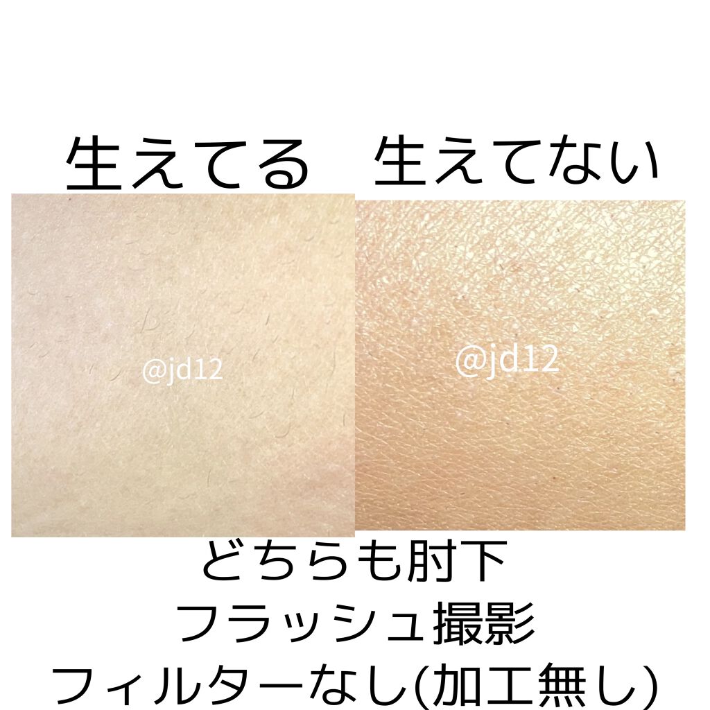 家庭用脱毛器 ケノン Ke Non エムテックの口コミ 私の公開フォルダにケノンのまとめがあるの By そろそろ大学生 乾燥肌 10代後半 Lips