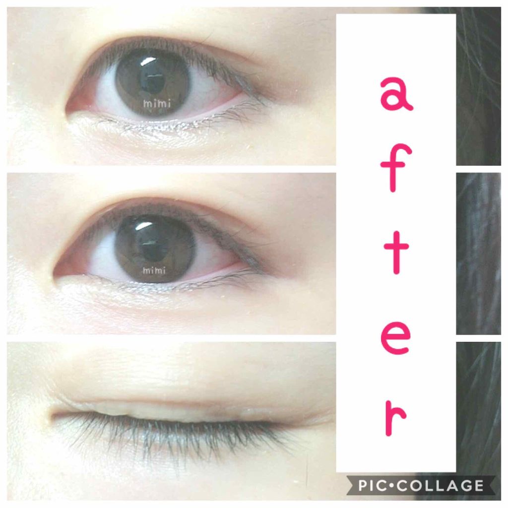 ふたえテープ 目立たず肌になじむ絆創膏タイプ Daisoの口コミ 超優秀 100均で買えるおすすめ二重まぶた用アイテム 重い一重の方必見 By mimico Lips