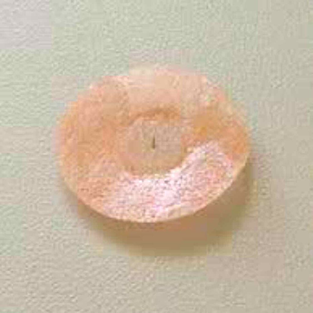 円皮鍼 セイリンの口コミ 首 肩のコリで顔面の血流も悪くなっているよ By Ikm11 アトピー肌 30代後半 Lips