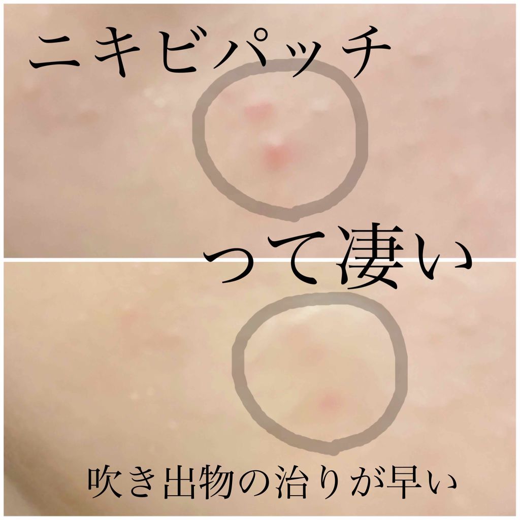 エラバンドパッチ Elabandの口コミ ブラ By Maimai 乾燥肌 30代前半 Lips