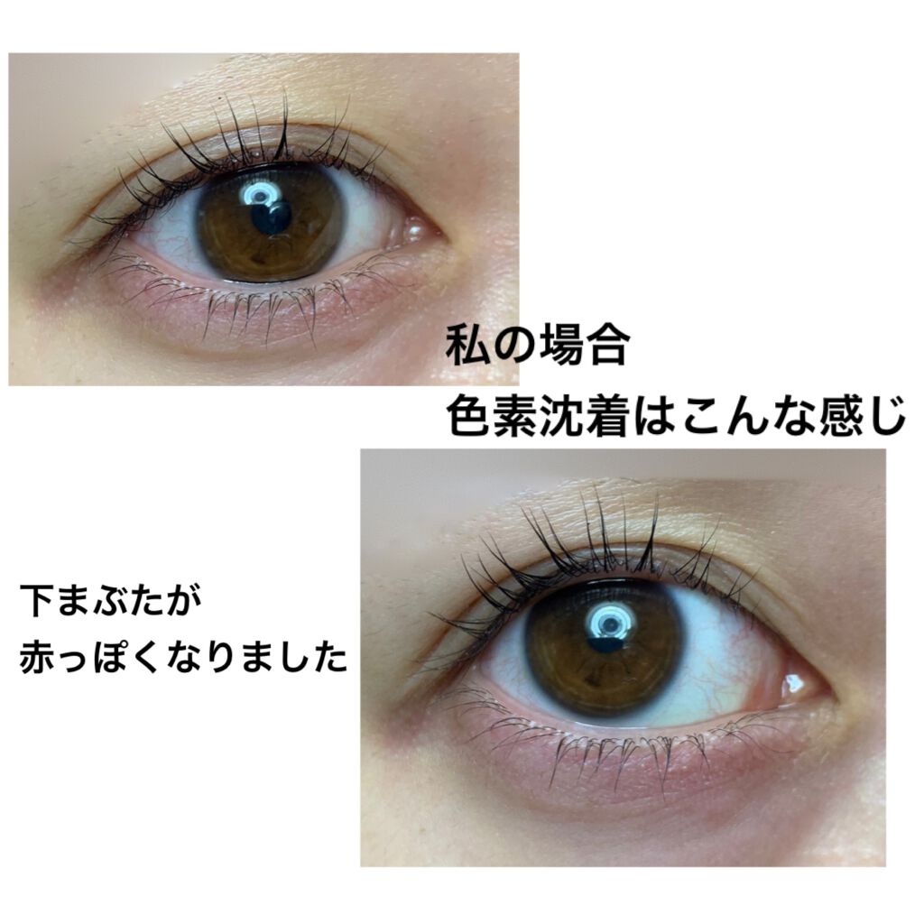 Emaked 水橋保寿堂製薬の効果に関する口コミ まつ毛美容液探してると必ずと言っていいほど By ただの櫻井 敏感肌 代前半 Lips