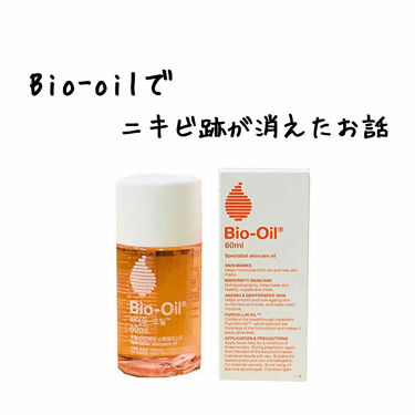 バイオイル バイオイルの使い方を徹底解説 ニキビが酷かった5年くらい前に 治らないか By Runa 敏感肌 代前半 Lips