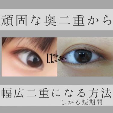 二重になる方法 のび る アイテープ 絆創膏タイプ Daisoの使い方や二重メイク こんにちは ﾅﾘﾀﾉで By ﾅﾘﾀﾉ 10代前半 Lips