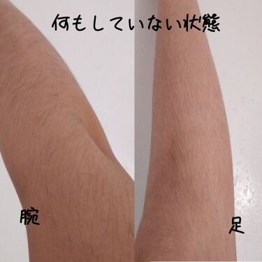 Fasiz607c Ipl光脱毛器 Fasizの口コミ ゴリラ女と言われた剛毛女がついに毛の処理を By ねねち 敏感肌 Lips