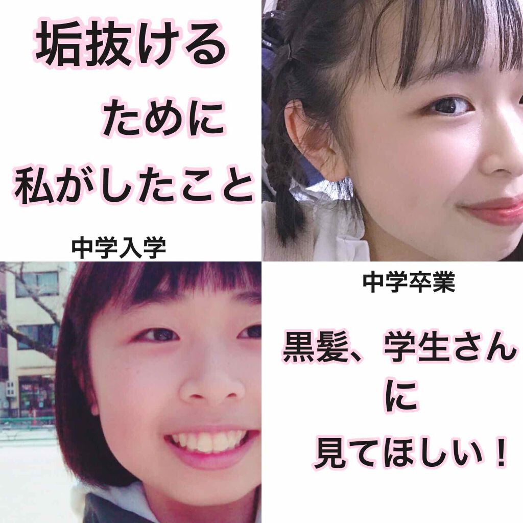 二重になる方法 のび る アイテープ 両面テープタイプ Daisoの使い方や二重メイク 今日の朝私が顔のマッサ By 音 Lips