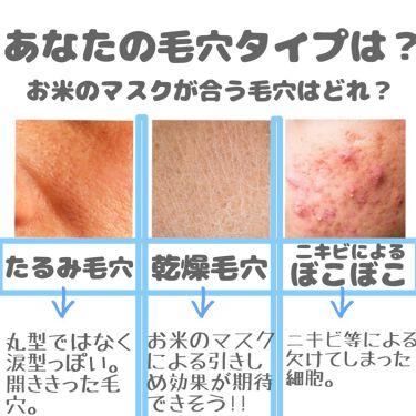 準備ができて クリップ みがきます お 米 の マスク ニキビ Muitobem Jp