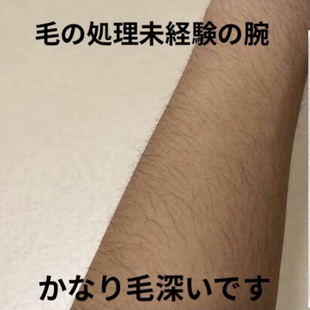 家庭用脱毛器 ケノン Ke Non エムテックの口コミ 毛深すぎる女子の腕毛記録 需要ありです笑 By Ria フォロバ 混合肌 10代後半 Lips