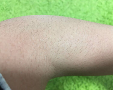 パイナップル豆乳ローション 鈴木ハーブ研究所を使った口コミ こんにちあずー あずきです 今回は私の By あずき168 フォロバ100 敏感肌 10代前半 Lips