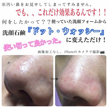 ドット ウォッシー洗顔石鹸 ペリカン石鹸の効果に関する口コミ ２枚目 汚い肌載せてます シミだらけで By いまもん Lips